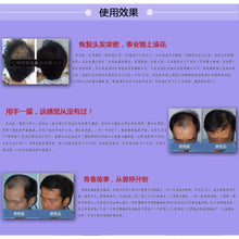 Load image into Gallery viewer, Organic Hair Growth Essence Hair Loss Products
