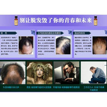 Load image into Gallery viewer, Organic Hair Growth Essence Hair Loss Products