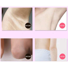 Load image into Gallery viewer, Dark-Off Skin Whitening Cream Skin Cream