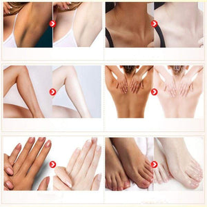 Dark-Off Skin Whitening Cream Skin Cream