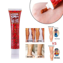 Load image into Gallery viewer, Dragonvein - Varicose &amp; Spider Veins Treatment Cream Cosmetics