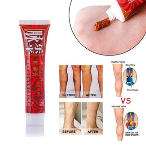 Dragonvein - Varicose & Spider Veins Treatment Cream Cosmetics
