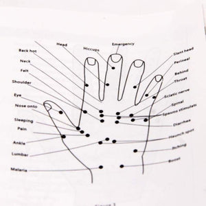 Electronic Acupuncture Pen Health