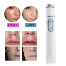 Load image into Gallery viewer, IPL Laser Acne Remover Face Skin Care Tools