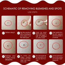 Load image into Gallery viewer, Skin Tag Remover Gesicht Hautpflege Werkzeuge