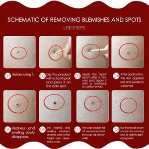Skin Tag Remover Gesicht Hautpflege Werkzeuge