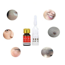 Load image into Gallery viewer, Skin Tag Remover Gesicht Hautpflege Werkzeuge