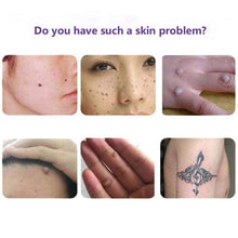 Load image into Gallery viewer, Skin Tag Remover Gesicht Hautpflege Werkzeuge