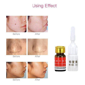 Skin Tag Remover Gesicht Hautpflege Werkzeuge